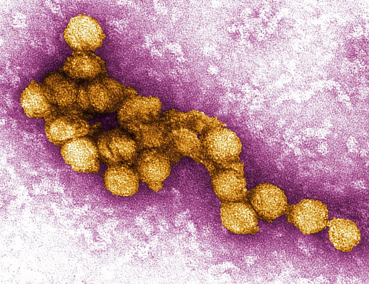 Mengerikan Virus West Nile 2024